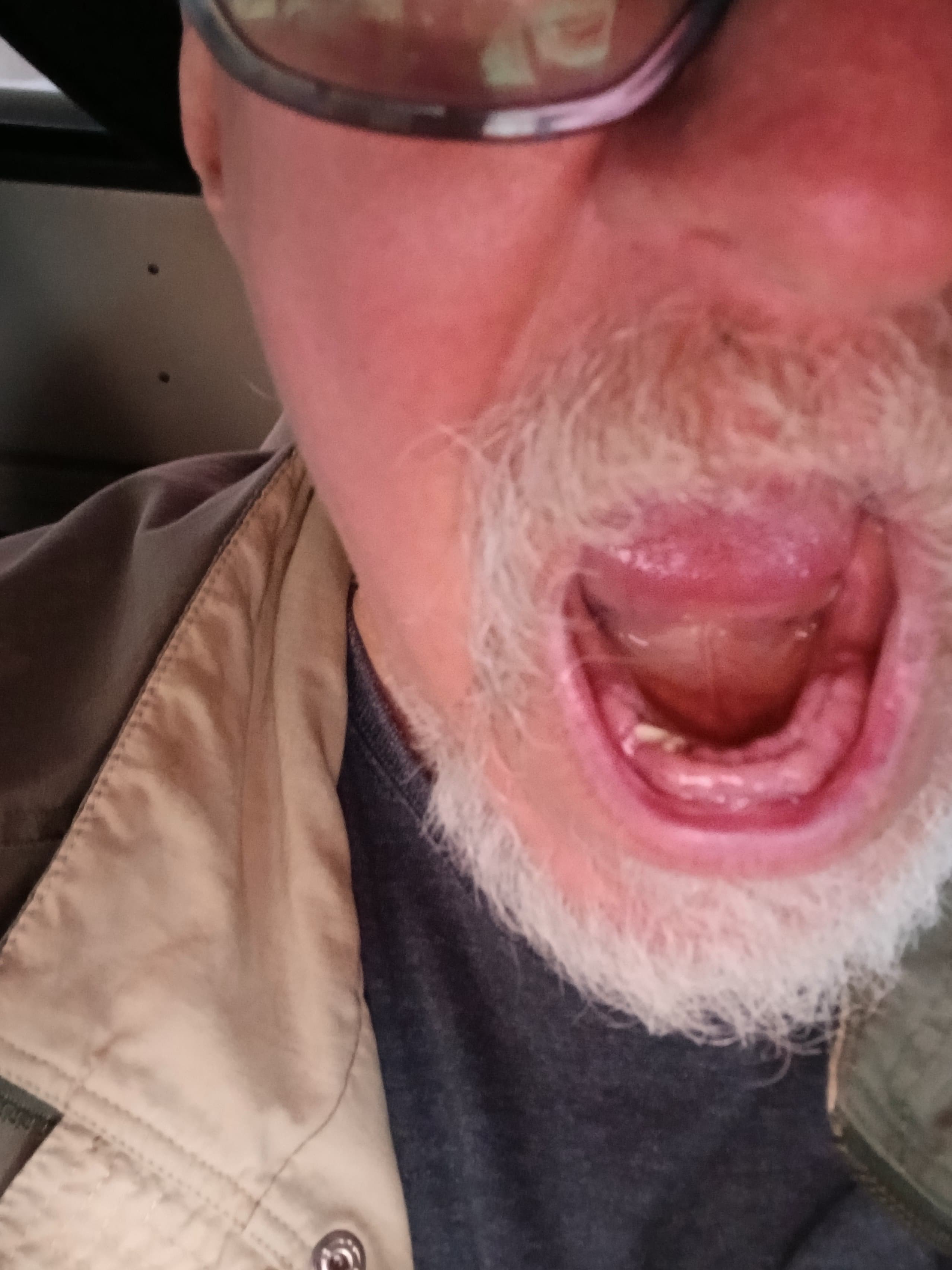 Complaint image 1